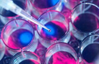 In Medical First, Woman’s Type 1 Diabetes Seemingly Cured by Stem Cells